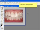 Adobe Photoshop. Dantų balinimas nuotraukoje