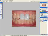 Adobe Photoshop - Dantų balinimas