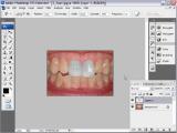 Adobe Photoship CS3 Extended. Dantų balinimas