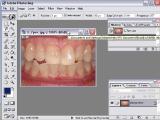 Adobe Photoshop: Dantų balinimas