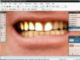 Paint.NET Dantų balinimo pamoka